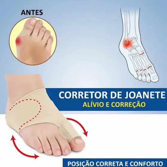 Corretor Joanete Par De Meias Corretor Ortopédico Joanetes Alívio de Dor Pé
