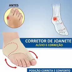 Corretor Joanete Par De Meias Corretor Ortopédico Joanetes Alívio de Dor Pé