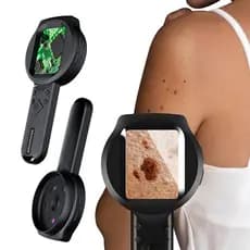 Máquina Analisadora De Pele Microscópio Digital 2.8in Dermatoscópio Facial Tela Portátil Lupa