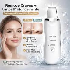 Aparelho Removedor de Cravos Ultrassônico Peeling Facial Profissional Limpeza de Pele Profunda Antirrugas Espátula