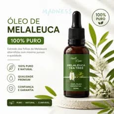 Óleo Essencial De Melaleuca 100% Puro 30ml Contra Micose Acne - Alta Concentração - 100% Natural