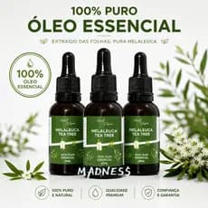 Óleo Essencial De Melaleuca Tea Tree 100% Puro Natural 30ml Premium Para Pele Unhas Aromaterapia Qualidade Profissional