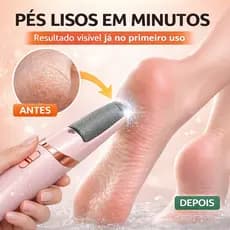Lixa de Pé Elétrica Recarregável Removedor de Calos Pedicure Profissional À Prova D’Água USB Bivolt