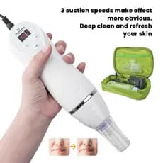 Aparelho Removedor de Cravos e Espinhas Sugador Elétrico Peeling Diamante Limpeza de Pele