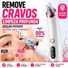 Removedor de Cravos a Vácuo Limpeza Facial Sucção Suave Eletrico Recarregável
