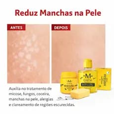KIT MIKOZIU para fungos manchas pano branco micoses coeceiras alergias clareador sabonetes e creme