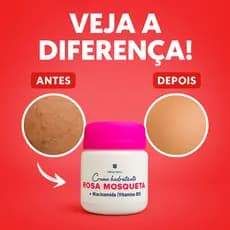 Creme Rosa Mosqueta Facial | Ação Clareadora para Melasma, Acne e Olheiras
