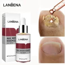 LANBENA Sérum Reparador de Unhas para Tratamento de Micose de Unha / Fungo