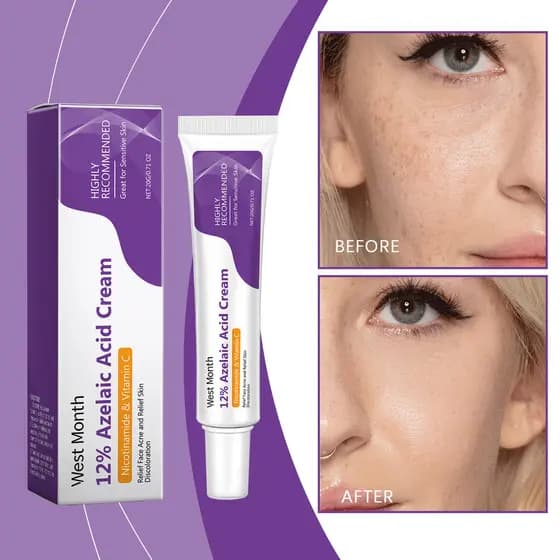 Creme Facial De Ácido Azelaico , Soro 12 % , Niacinamida E Vitamina C-Produtos De Beleza Para Oeste Do Mês