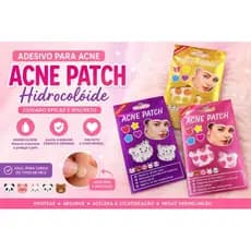 Adesivo para Acne Hidrocoloide Acne Patch Anti Espinha Kit Cute
