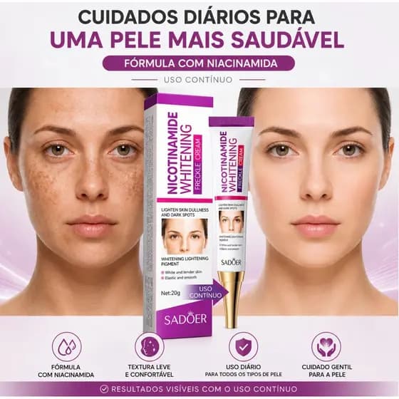 Clareador Facial Anti Manchas  Sardas  Creme com Niacinamida + Vitamina C  Uniformiza Tom da Pele