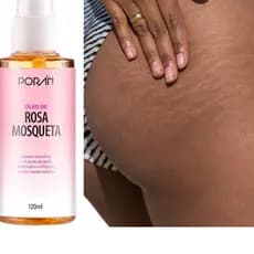 Óleo de Rosa Mosqueta Selvagem Corporal Reduz Estrias Estimula o Colágeno De 120ML