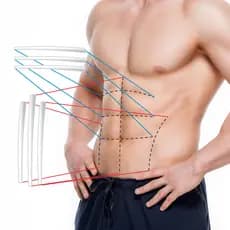Lamina De Silicone Para Pós Cirurgia Lipo Hd Lad Canaleta 3 Unidades