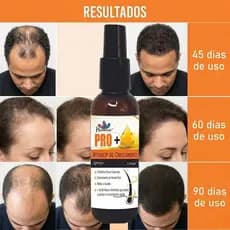 Super Tônico Ativador Capilar Havana PRO+ Spray 120ml Crescimento de Cabelo Reduz Queda