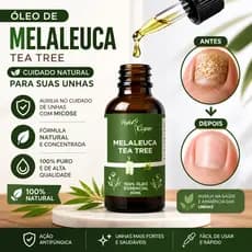 Óleo Essencial De Melaleuca 100% Puro 30ml Contra Micose