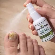Kit Mycostop Spray para Micose de Unha, Antimicótico 30ml spray Doctor-G