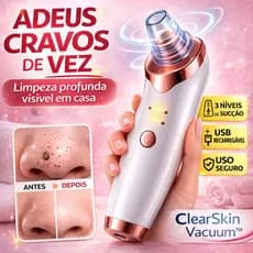 Removedor de Cravos Elétrico Recarregável ClearSkin a Vácuo USB 3 Níveis Limpeza Facial