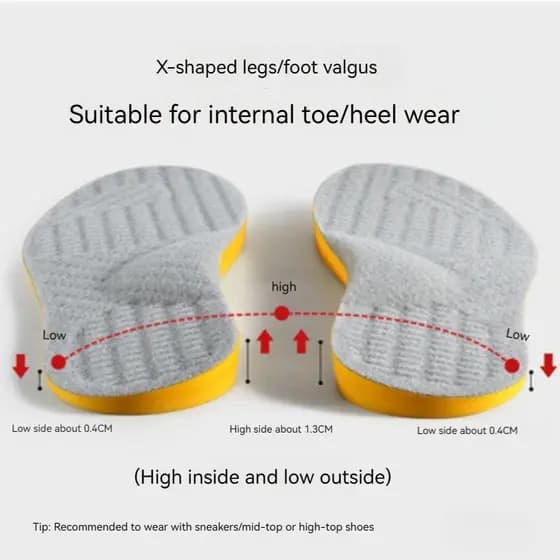 Palmilha de correção, Palmilha interna externa de oito caracteres, Palmilha plana para pés, Palmilha em forma de O, Palmilha em arco, Adequada para palmilha de perna em forma de X, Palmilha para pés Valgus