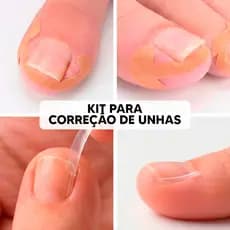 Kit para Correção de Unhas Desencravar – Corretores + Adesivos Ortopédicos (Cuidado Completo)
