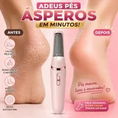 Lixa de Pé Elétrica Recarregável à Prova D’Água Bivolt Removedor de Calos USB Profissional