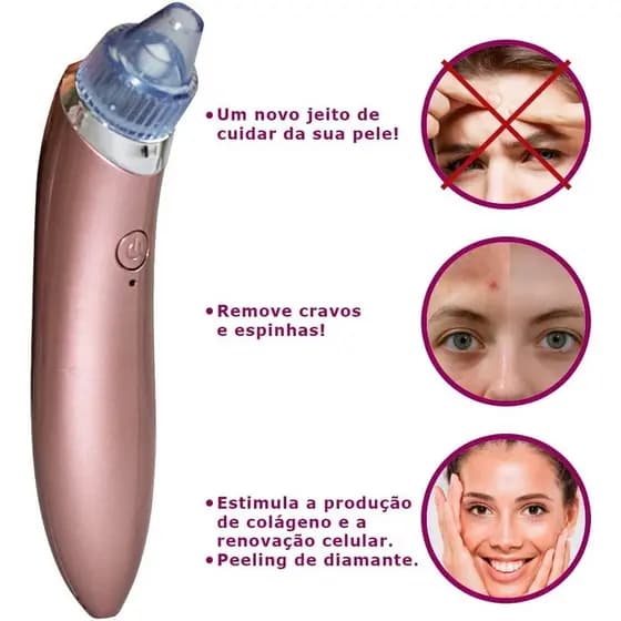 Removedor de Cravos USB Espinhas Elétrico Sucção