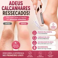 Lixa de Pé Elétrica Recarregável Removedor de Calos Pedicure Profissional À Prova D'Água USB