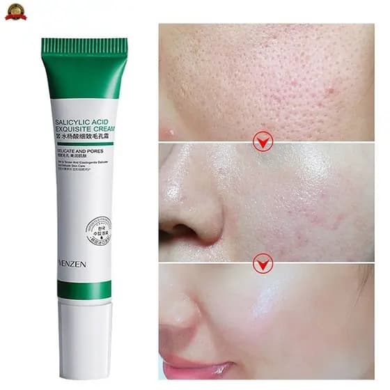 Creme De Ácido Salicílico 20ml Para Remoção De Poros/Acne E Clareamento De Acnes/Antigo/Controle Oleoso Maquiagem Cuidad