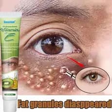 Grânulos De Gordura Removedor Creme Para Os Olhos Eficaz Remover Inchaço Anti-Partículas Milia Produto Reparação Cuidado
