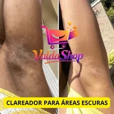 Creme Clareador Corporal para Cuidados com a Pele Uso Diário Axila e Virilha e Áreas Escurecidas
