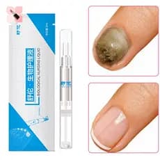 Caneta Para Unhas Onychomiccosis Paronychian Infecção De Ervas Dos Pés De Saúde