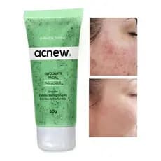 Acnew Esfoliante Facial Para Pontos Negros Combate Cravos Abelha Rainha