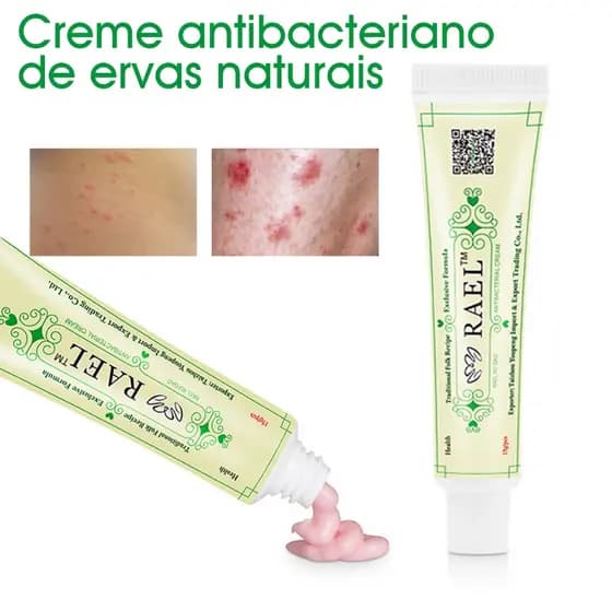 Pele Creme, Creme antibacteriano de ervas naturais, Dermatite Eczematóide Pomada Eczema Da Cuidados Com A Fungos Inibição Alívio Coceira Vermelho Erupa