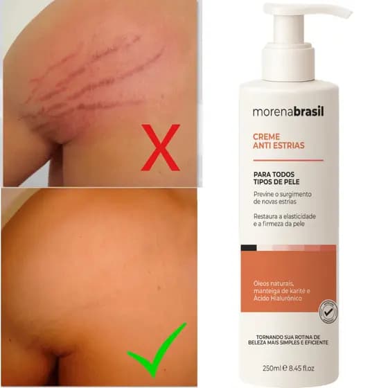 Creme Anti-Estrias Morena Brasil - Ação Poderosa com Colágeno e Elastina