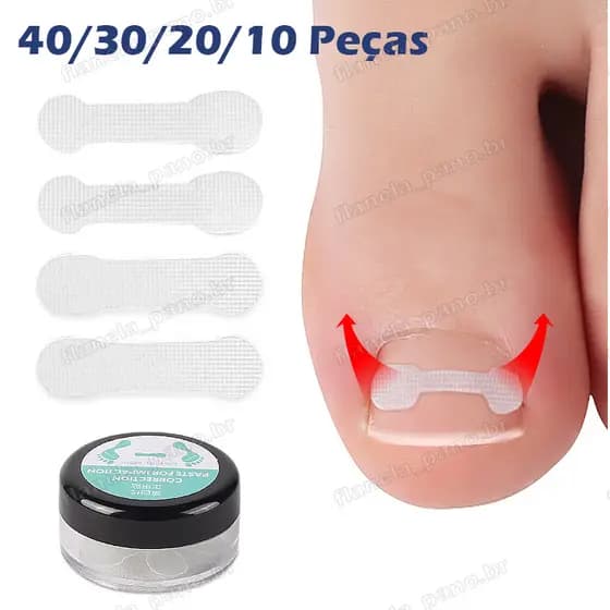40/30/20/10 Peças Fita Órtese Corretora para Unha Encravada, Ferramenta Desencravadora