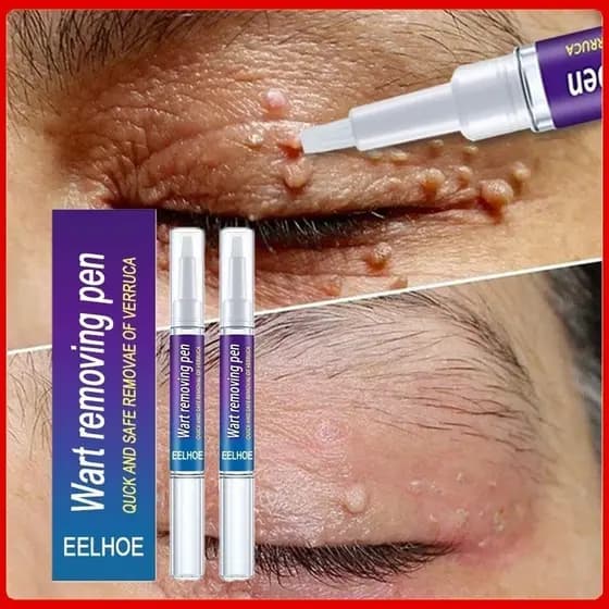 Novo Creme De Remoção Granular Para Reparo Profundo Da Pele