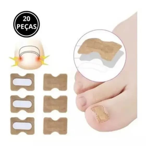 Kit 20 Adesivos Órtose Correção Unhas Encravadas Saúde Dedo