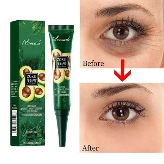 Creme instantâneo anti-rugas para os olhos, anti-olheiras, bolsas nos olhos e produtos para o cuidado da pele com inchaç