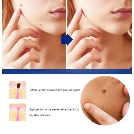 Gel hidratante natural Creme para remoção de manchas Suave para a pele, fácil de remover, adequado para uso facial