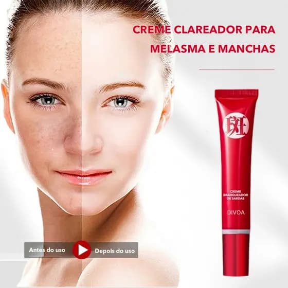 Creme Clareador Facial Remove Melasma Manchas Escuras Sardas Sol Clareia Hidratante Uniformiza Tom da Pele 20g