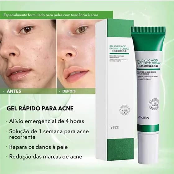 20ml Creme De Ácido Salcílico Para Remoção De Poros/Acne E Clareamento Acnes/Clareamentos/Antiridade/Controle De Óleo