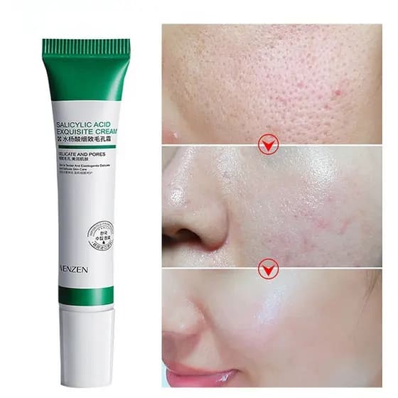 20ml Creme de Ácido Salicílico para Tratamento de Poros / Acne e Clareamento / Controle de Oleosidade