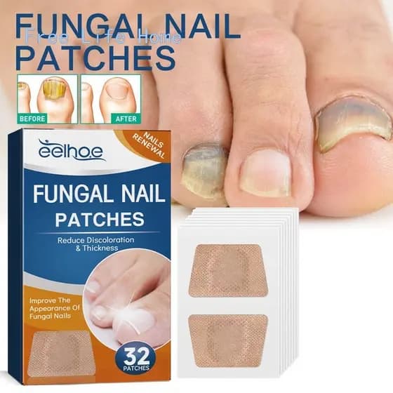 32 Adesivos Antifúngicos Para Tratamento De Unhas , Reparos De Onicomicose , De Venda Quente