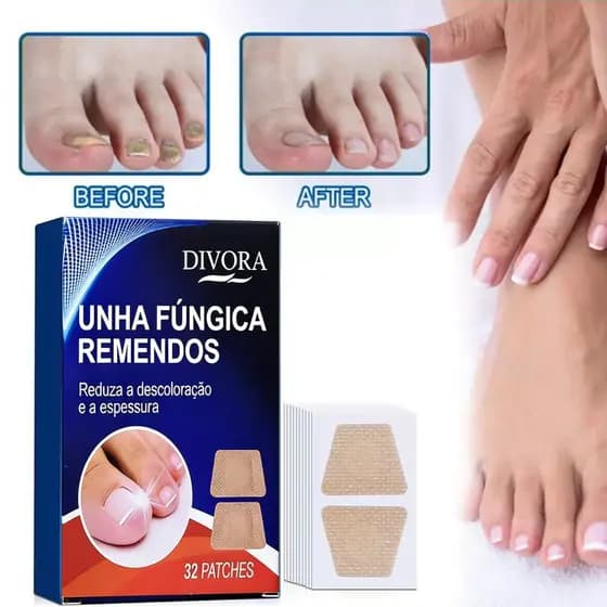 32/64 Unidades De Adesivos Para Tratamento Fúngico De Unhas