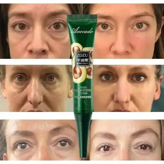 Creme De Olhos Gel Dark Circles Remoção Instantânea Antirrugas Anti-Bolsas/Anti-Puffiness Apertar Retinol 20g