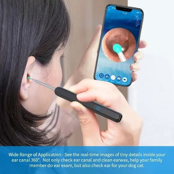 Sem Fio Inteligente Vision Ear Otoscosco Orelha Cera Ferramenta De Remoção Com Câmera 1080p yy-802