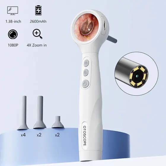 Otoscópio Visual Tela IPS 1080P HD Câmera Endoscópio Ouvido Nariz Pele