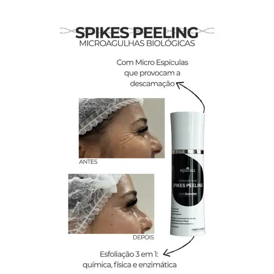 Spikes Peeling - Microagulhas Biológicas Tecnologia Coreana 30g - Microbooster