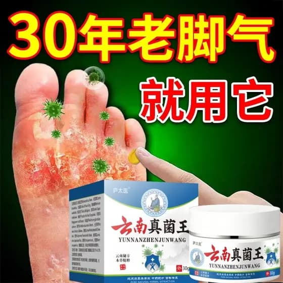 Yunnnan fungo rei pé peeling de ar coceira nos pés odor do pé coceira creme para os pés evitar imersão em água peeling p