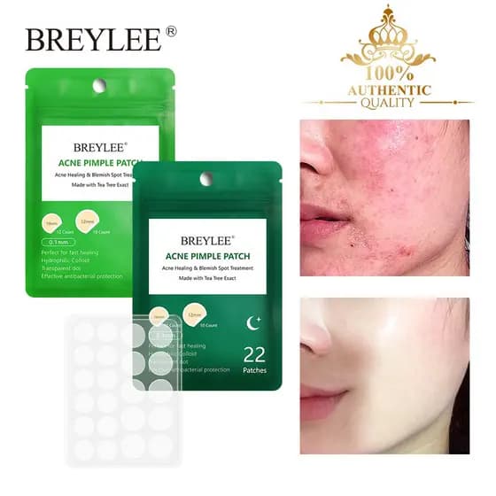 BREYLEE Adesivo para Acne e Espinhas, Tratamento de Acne, Remove Cravos, Cuidados com a Pele, Máscara Facial, Conjunto d