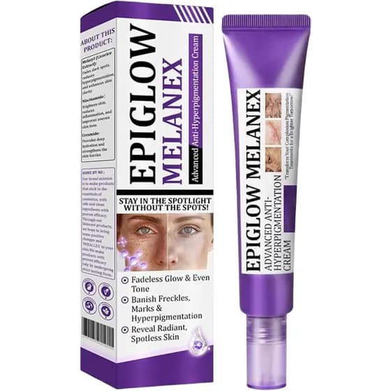 Creme Avançado para Remoção de Manchas no Rosto, Creme Removedor de Manchas Escuras, Corretor de Pele Facial 30g (1)